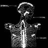 New - Disnihil - Future Cancers 7" - Tone Deaf Records